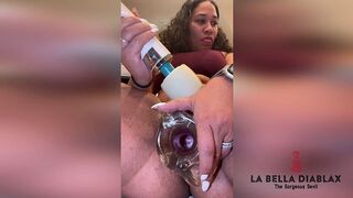 LABELLADX - Get a view of LaBella's cervix