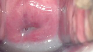 cervix