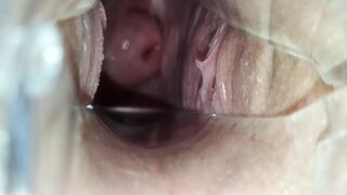 At the GYNECOLOGIST!! A speculum in the girl's pussy!!