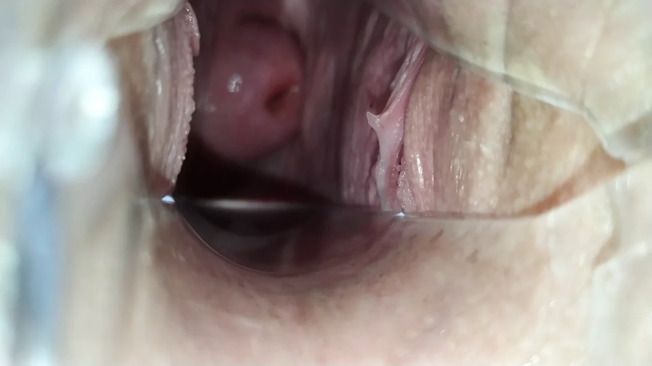 At the GYNECOLOGIST!! A speculum in the girl's pussy!!