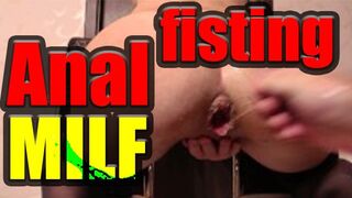 NOW FREE Dirty Anal Milf Fisting