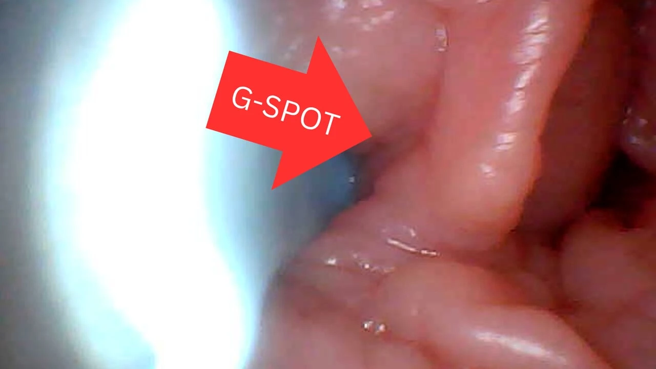 First time: An endoscope reveals the G-spot up close - without mountingl